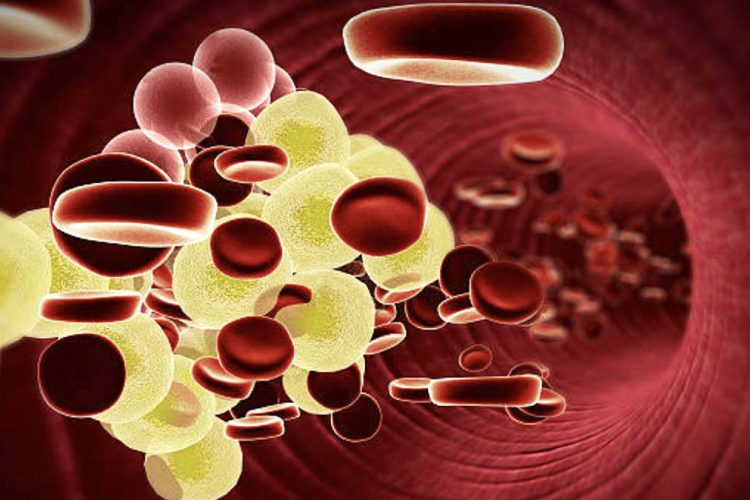 Shenjat të cilat paralajmërojnë se duhet të kontrolloni kolesterolin në gjak